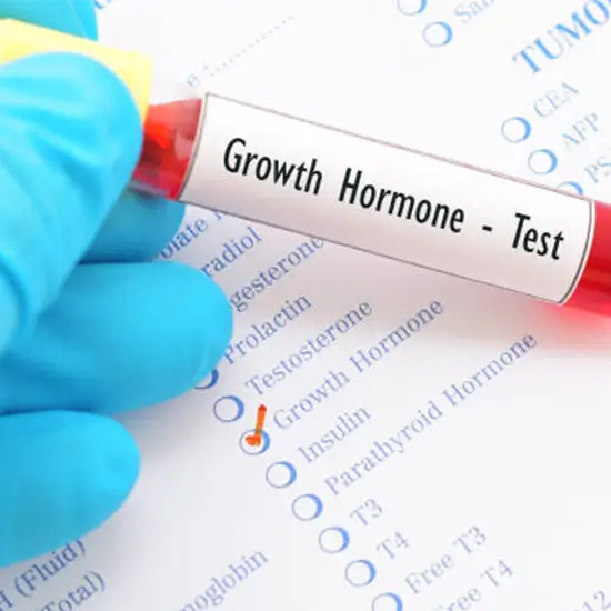 growth hormone antibody test